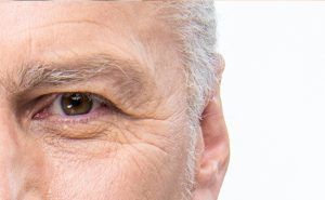Opthalmologist in Laguna Hills California discusses how to avoid aging your eyes