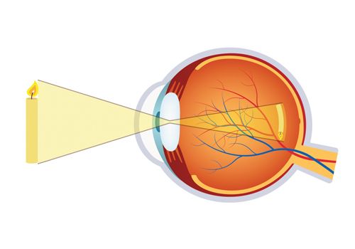 Understanding Myopia in Children and How We Can Help