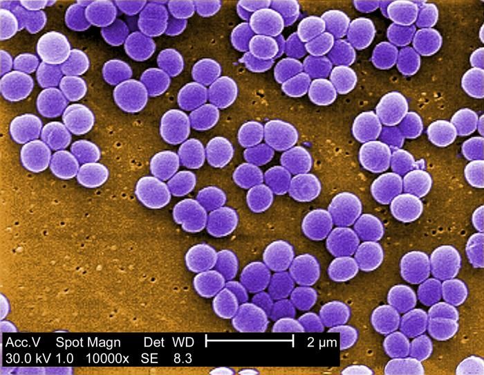 'Fortunate accident' may yield immunity weapon against antibiotic-resistant bacteria