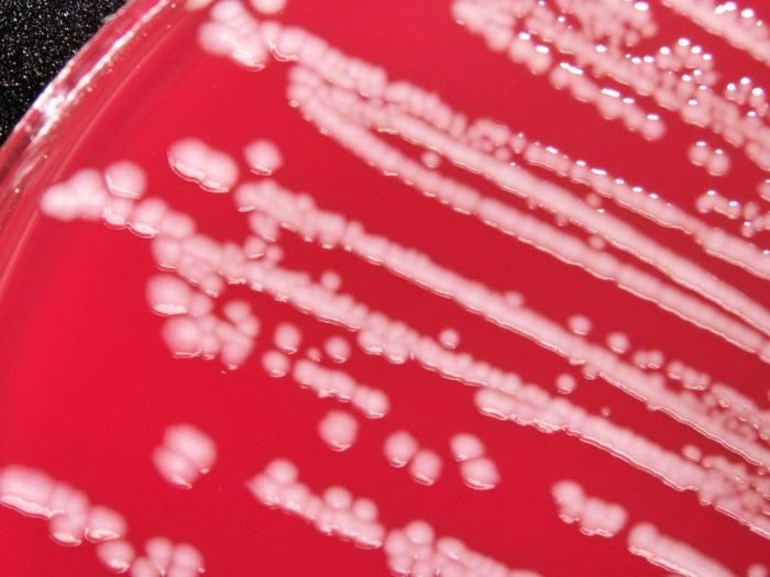 Study details how antimicrobial resistance slams Europe