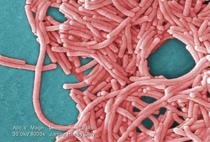 Legionnaires’ Disease sees update of prevention and control regulations in Spain
