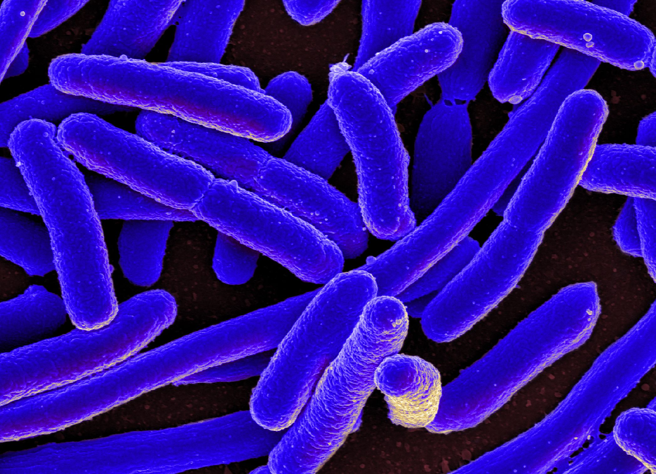 Outbreak Investigation of E. coli O121:H19 Frozen Falafel (October 2022)