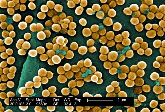 CARB-X IS FUNDING AFFINIVAX TO DEVELOP A NOVEL VACCINE TO PREVENT STAPHYLOCOCCUS AUREUS BACTERIAL INFECTIONS