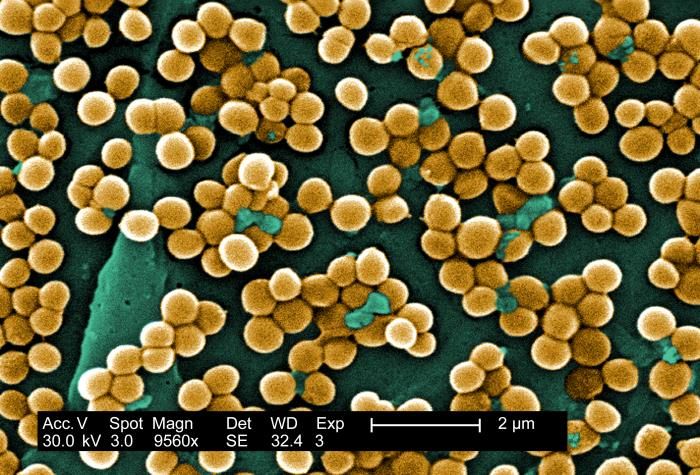 CARB-X IS FUNDING AFFINIVAX TO DEVELOP A NOVEL VACCINE TO PREVENT STAPHYLOCOCCUS AUREUS BACTERIAL INFECTIONS