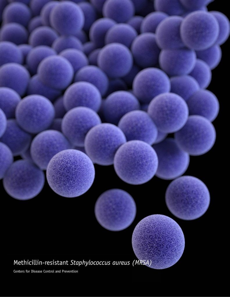 MRSA in the Environment