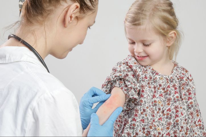 Dupilumab in children aged 6 months to younger than 6 years with uncontrolled atopic dermatitis: a randomised, double-blind, placebo-controlled, phase 3 trial