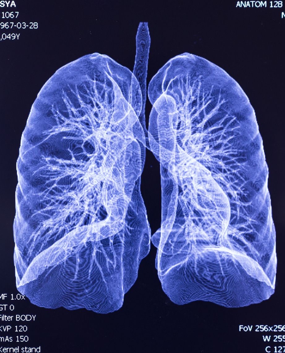Study identifies new potential drug target for pneumonia