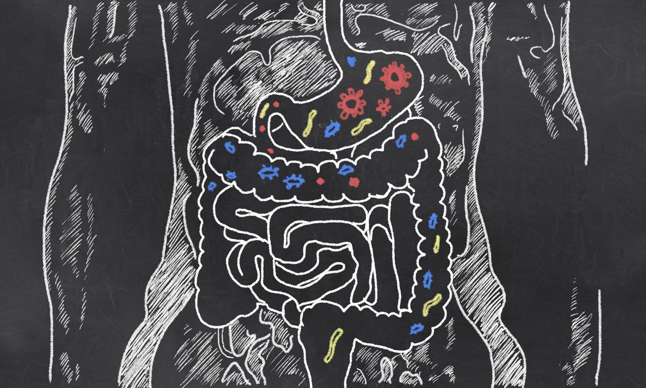 Diet, Gut Microbes, and Immunity