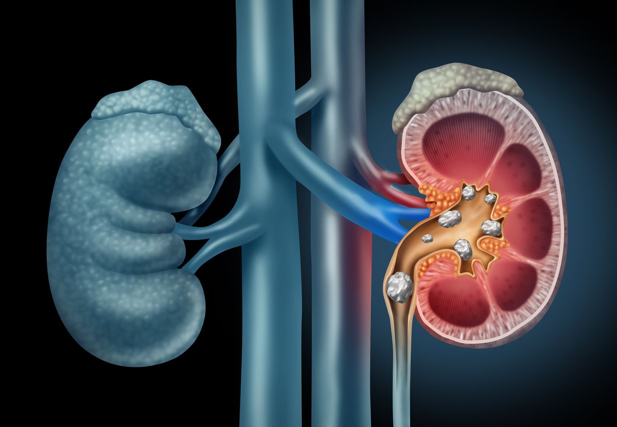 Weak kidneys? Pay attention but don't worry excessively
