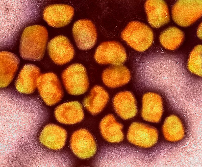 Researchers find monkeypox virus on hospital surfaces, in air