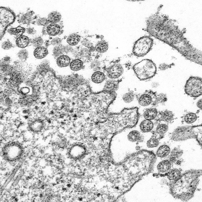 Progressive Increase in Virulence of Novel SARS-CoV-2 Variants in Ontario, Canada