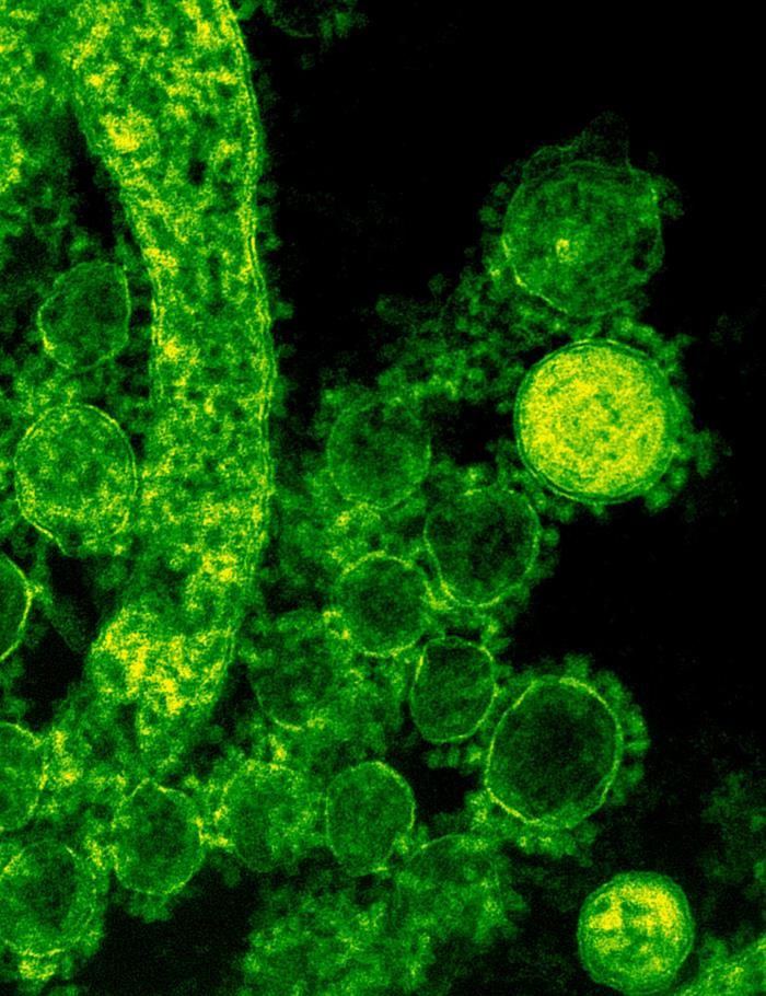 Ministry of Public Health (MOPH) declared that a case of Middle East Respiratory Syndrome (MERS-CoV) has been confirmed.
