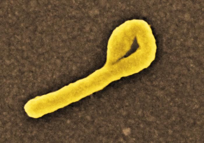Israeli quarantined due to possible exposure to Ebola in Uganda
