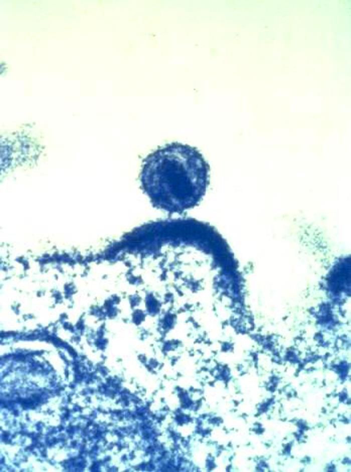 HIV infection drives interferon signaling within intestinal SARS-CoV-2 target cells