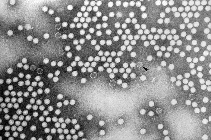 National incident declared over polio virus findings in London sewage