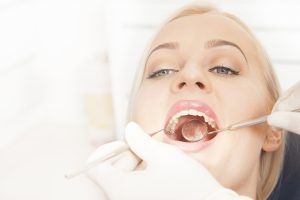 What You Can Expect When You Choose Clean Smile Dental