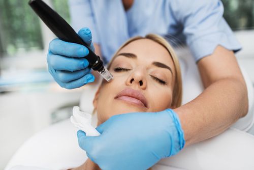 Microneedling in White Plains, NY