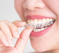 Invisalign