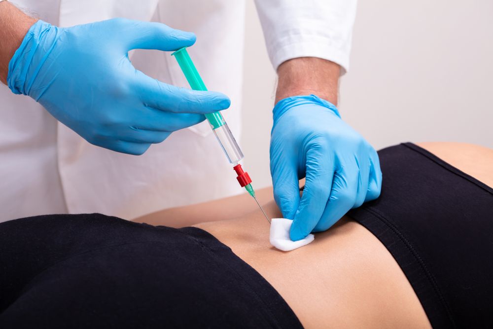 Exploring the Benefits of Epidural Steroid Injections in Pain Management