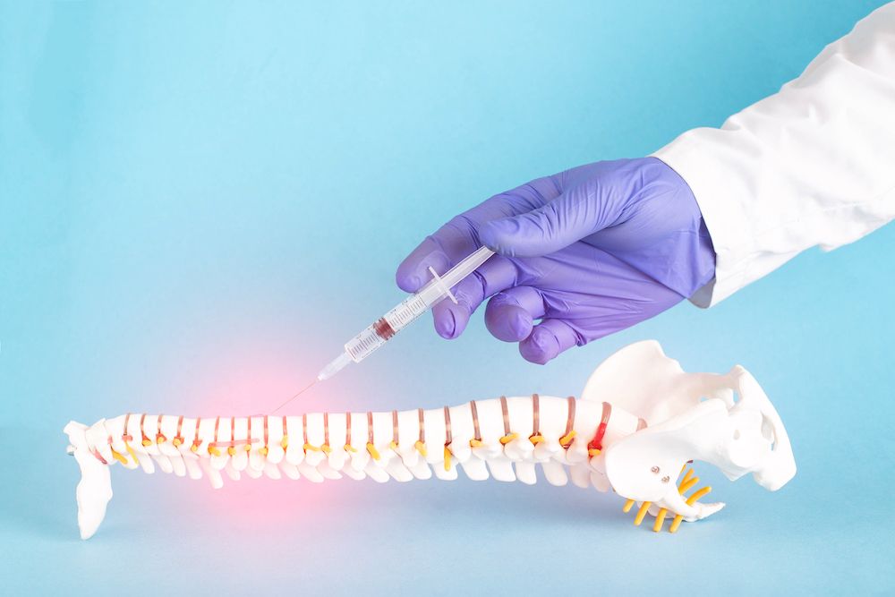 Using Facet Joint Injections for Physical Therapy