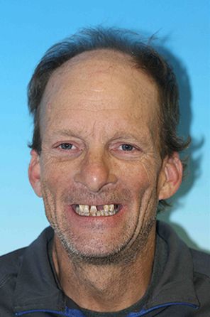 Man with a full set of dentures smiling for the camera