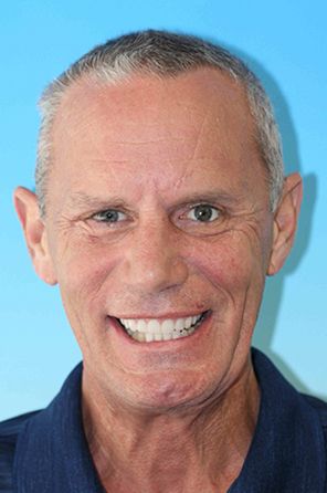 Man with new set of dentures smiling
