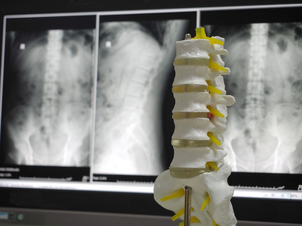 How Spinal Decompression Affects the Body