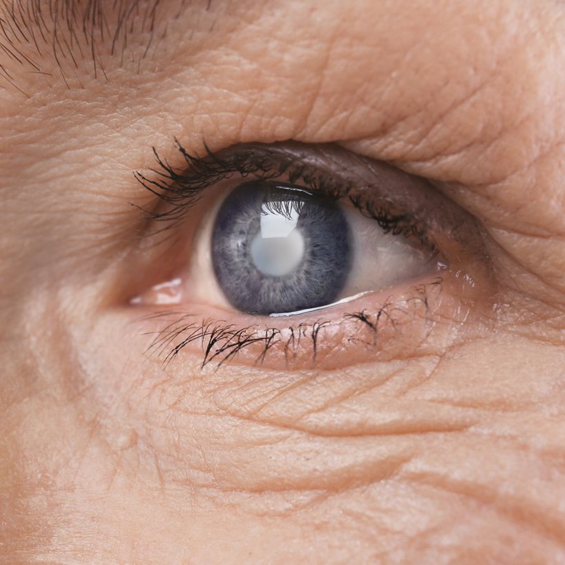 Eye Disease Management