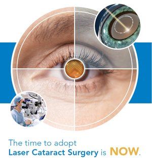 Laser-Assisted Cataract Surgery in Findlay & Lima, OH