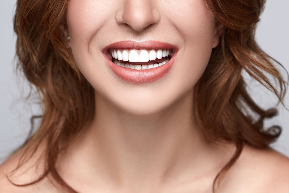 What to Expect with Professional Teeth Whitening?