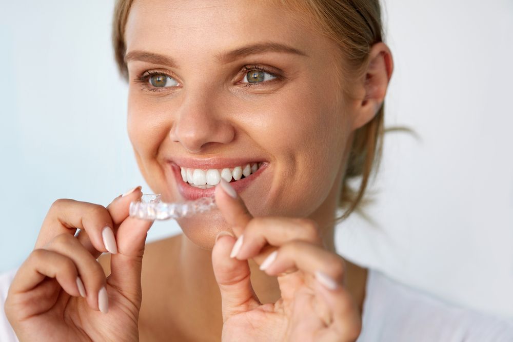 Benefits of Invisalign