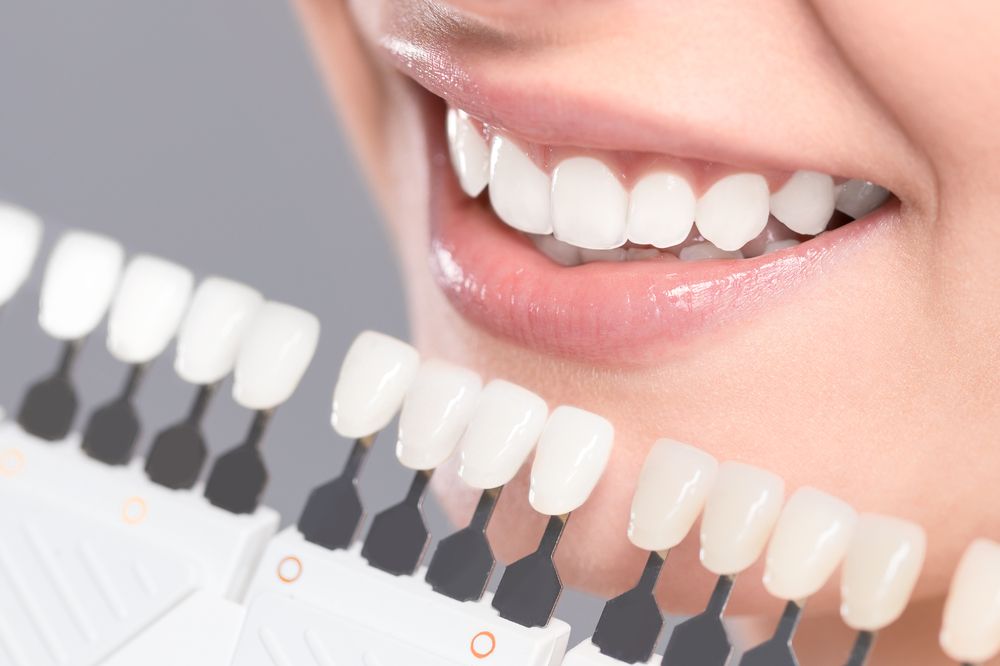Why Dental Implants Are the Top Recommended Solution for Missing Teeth