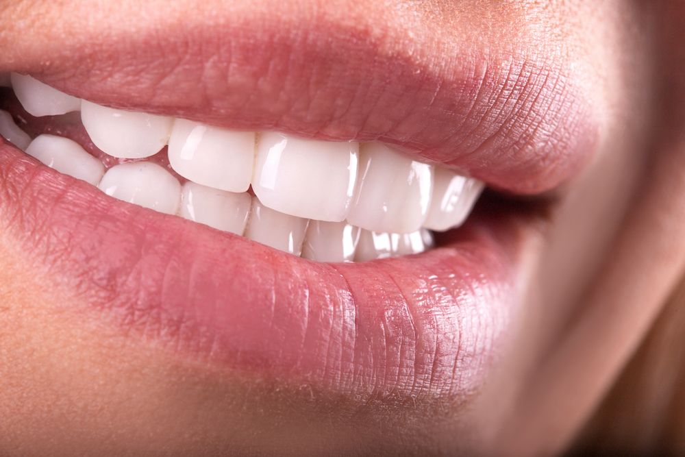 Is a Bone Graft Necessary Before Placing Dental Implants in the Jaw?