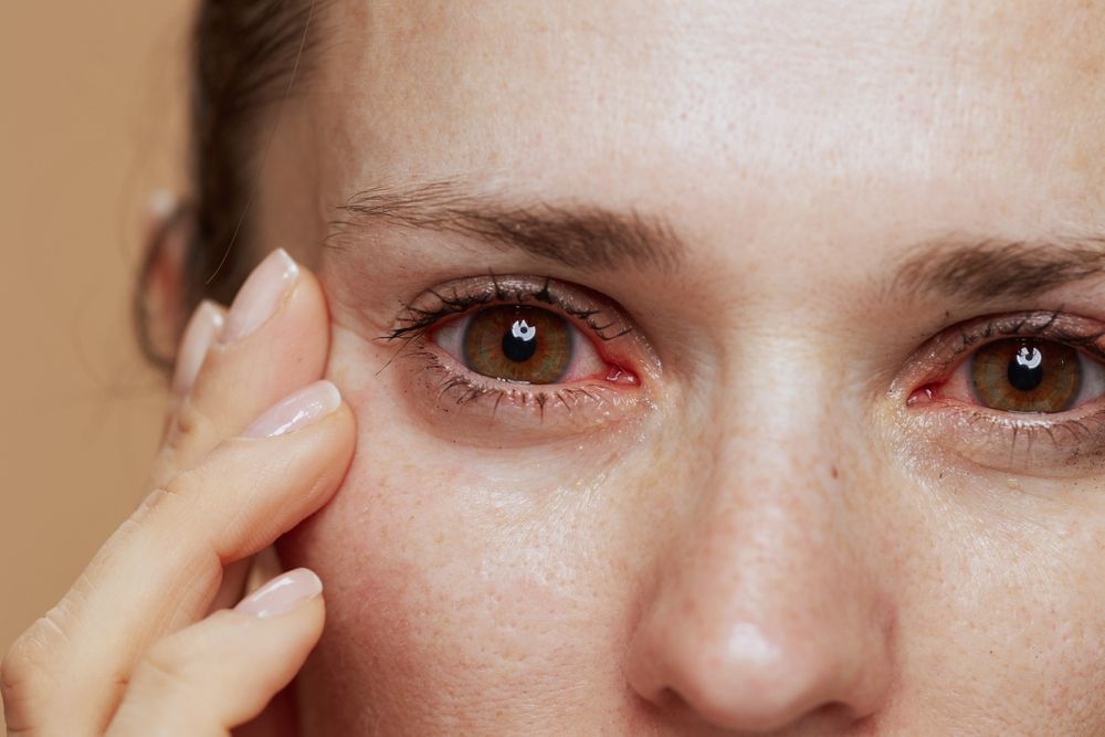 Dealing with Eye Infections
