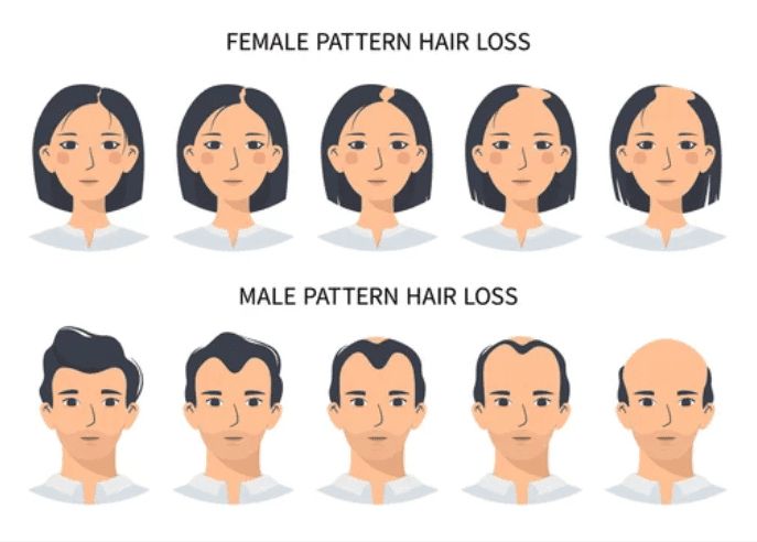 hair loss 