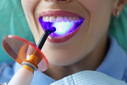 Teeth Whitening