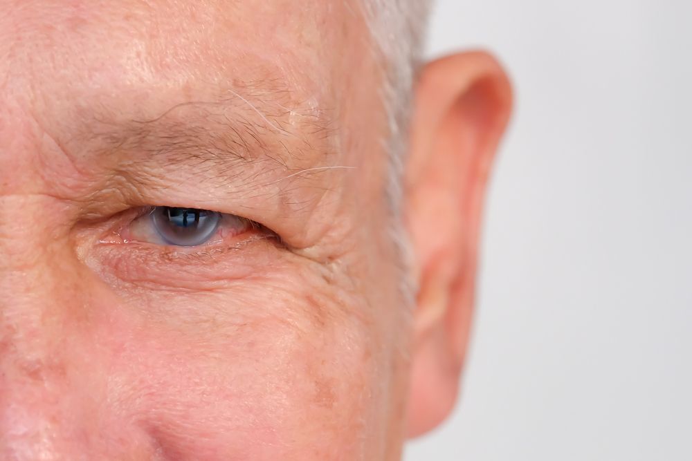How Can Prolonged UV Exposure Damage Eyes?