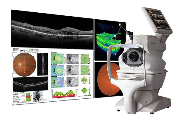 OCT (Optical Coherence Tomography)