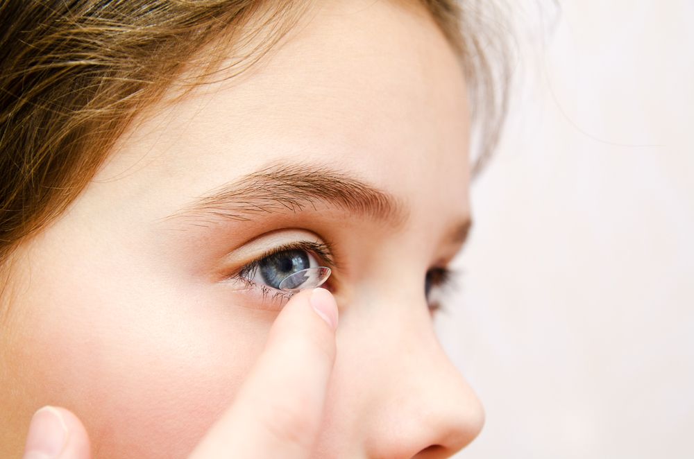 Candidates for Scleral Lenses