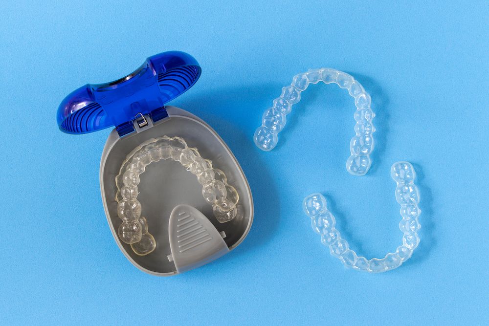 At What Age Can My Child Start Invisalign?