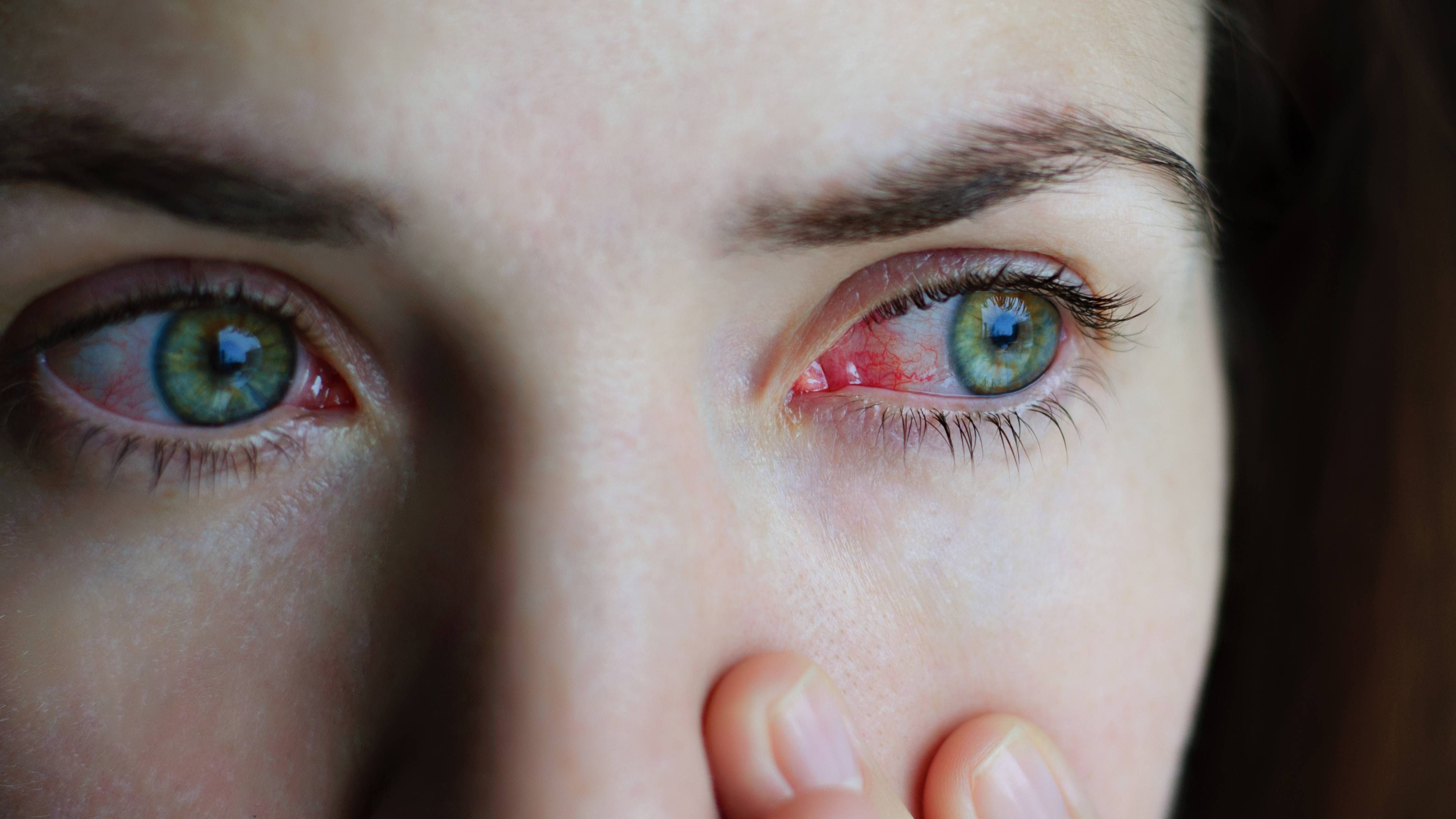Potentially Dangerous Eye Problems You Should Not Ignore