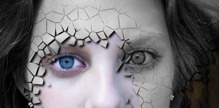 How to manage dry eyes if you are considering cataract or LASIK surgery