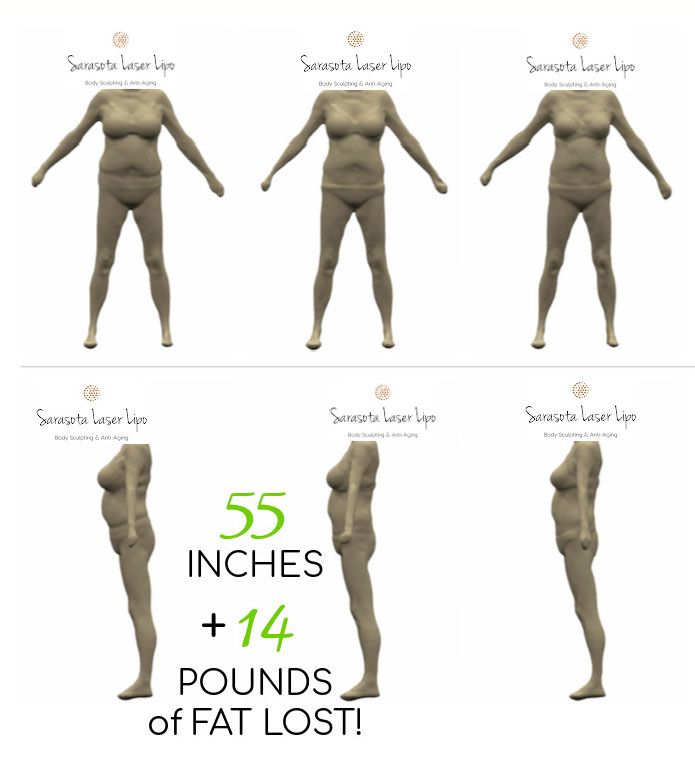 3D Body Scans Gallery