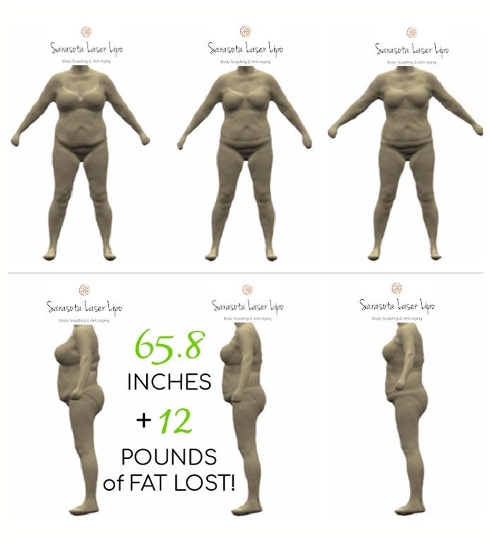 3D Body Scanners vs. Body Fat Calipers Which is Better