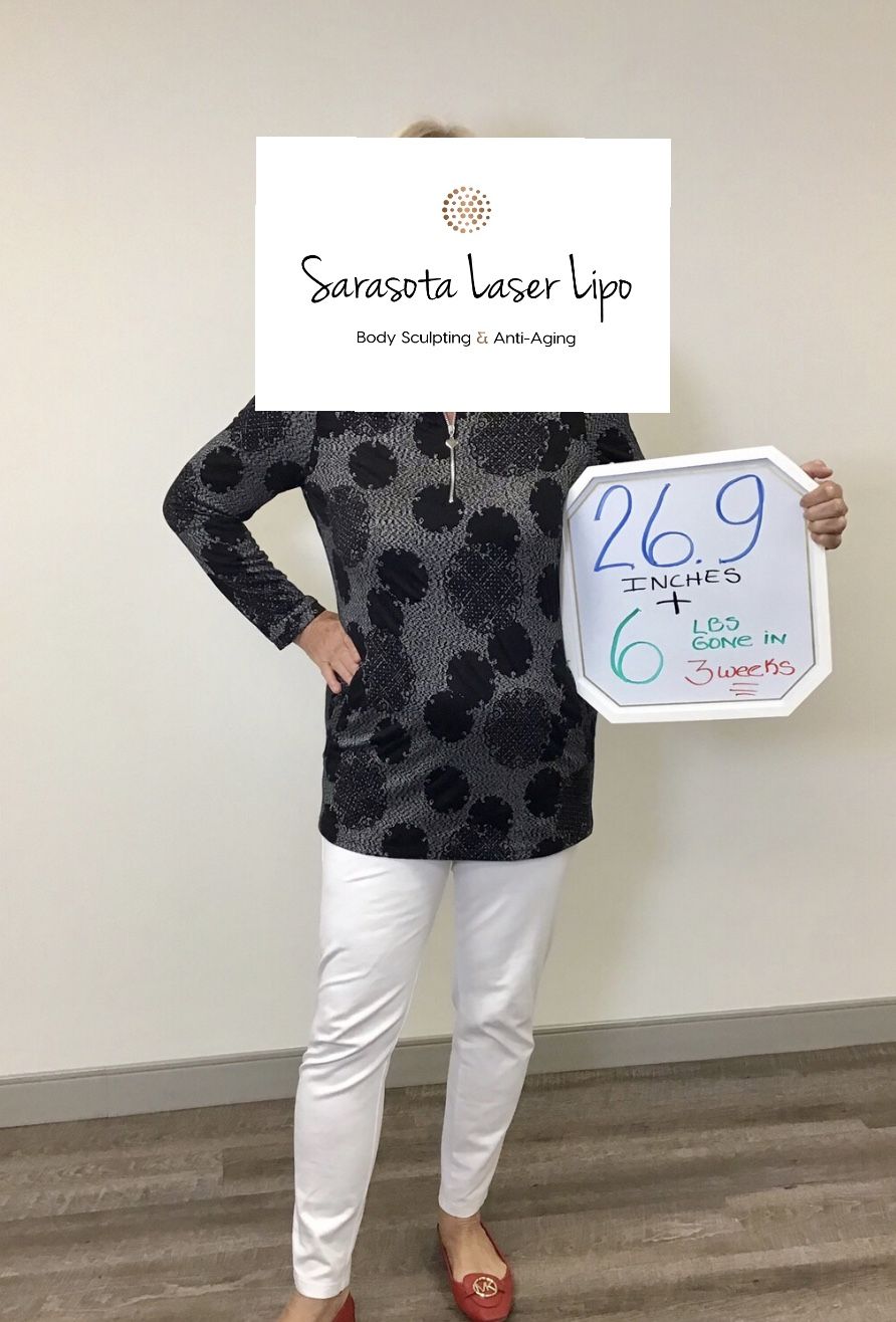 Weight Loss in Sarasota FL Before & After | Sarasota Laser Lipo