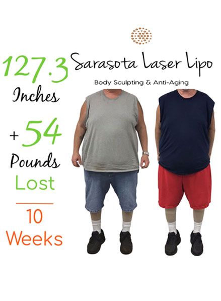 sarasota-weight-loss