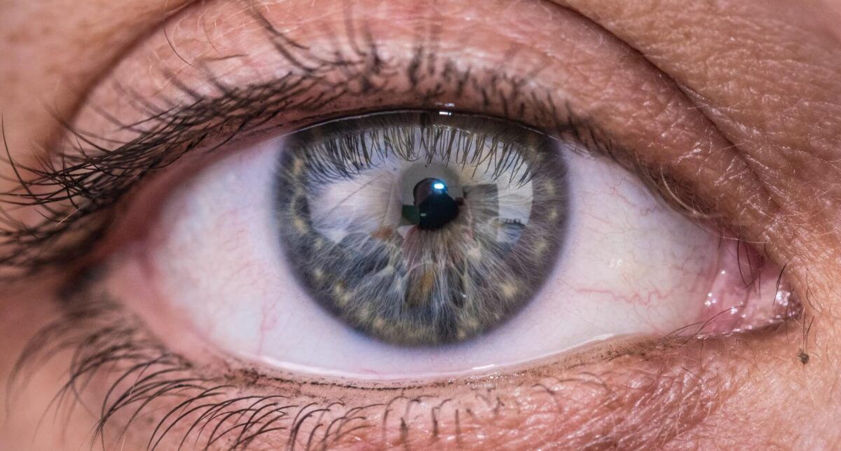 What is Fuch’s Corneal Dystrophy and How is it Treated?