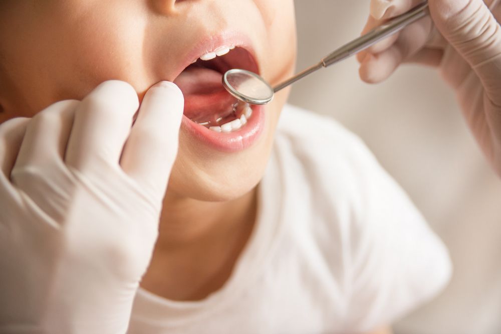 5 Important Benefits of Restorative Dentistry for Children