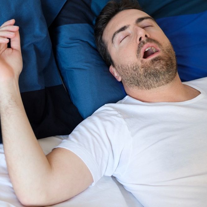 Sleep Apnea