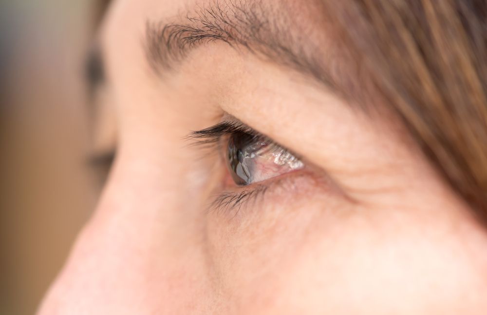 The Danger of Prolonged Eye Exposure to UV Rays